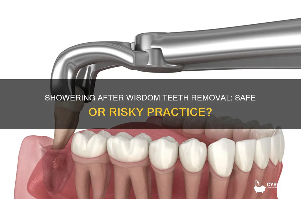 is it bad to shower after wisdom teeth removal