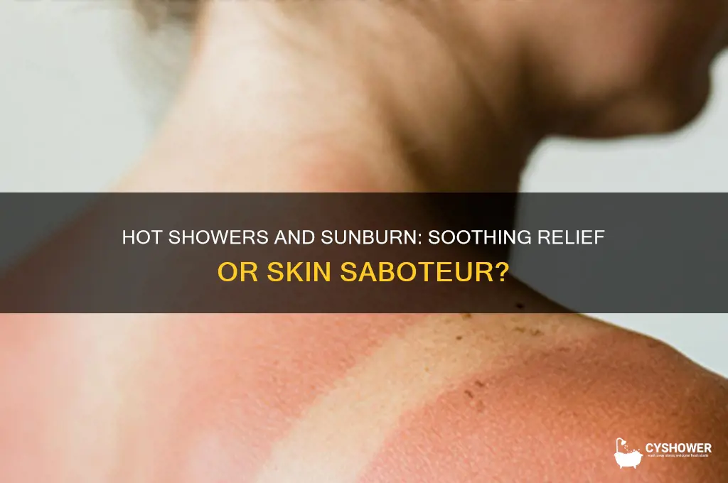 is it bad to take a hot shower while sunburned