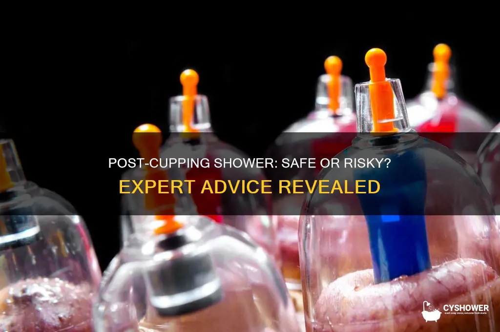 is it ok to take a shower after cupping