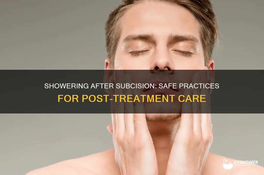 is it ok to take a shower after subcision