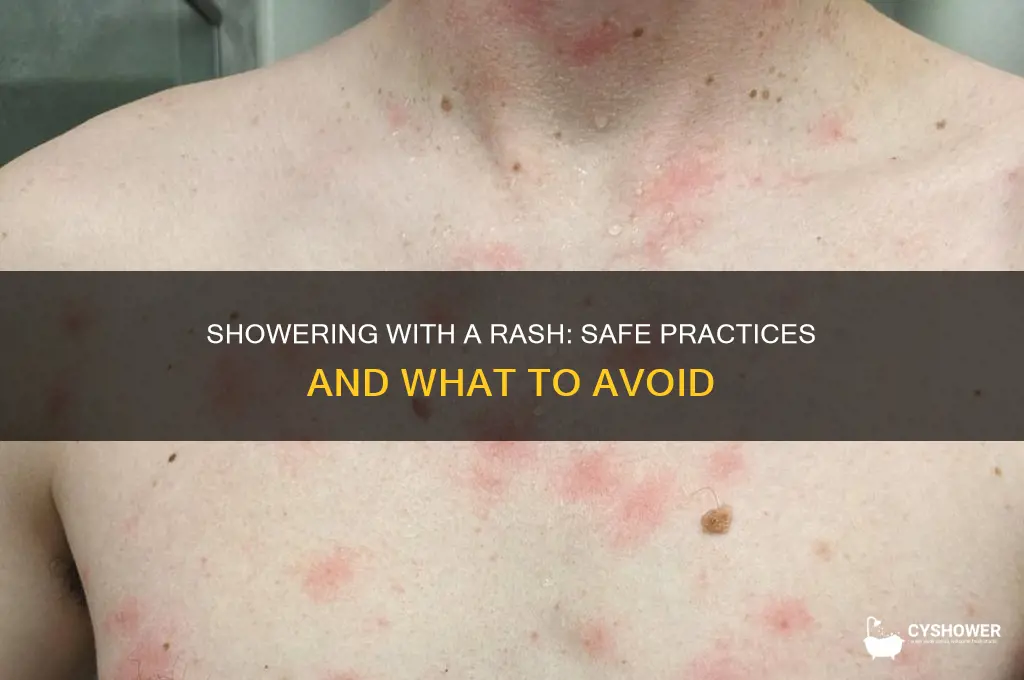 is it ok to take a shower with a rash