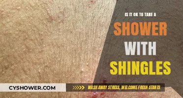 Showering with Shingles: Safe Practices and Precautions to Consider