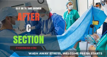 Post-C-Section Shower Guide: Safety Tips for New Moms
