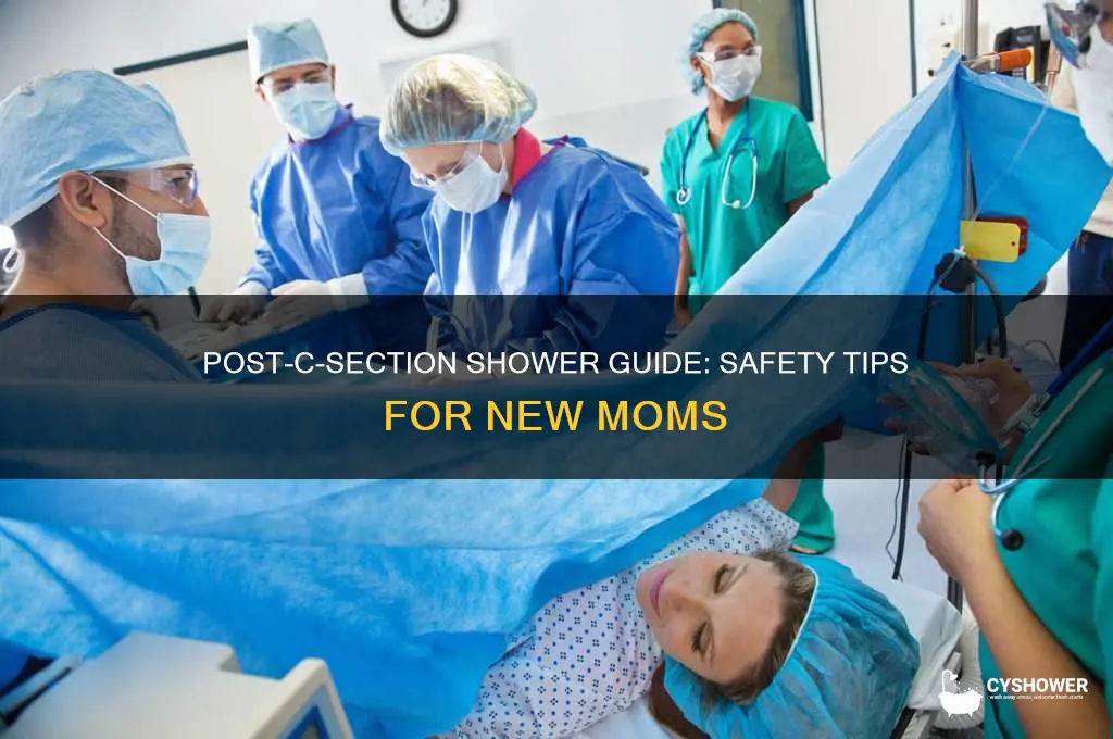 is it ok to take shower after c section
