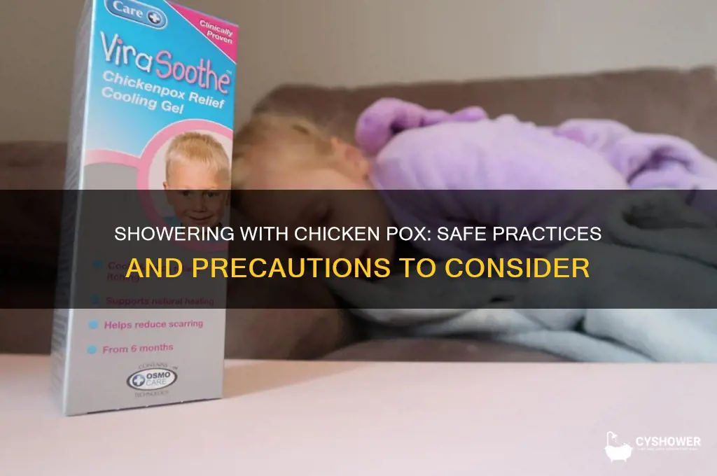 is it ok to take shower during chicken pox