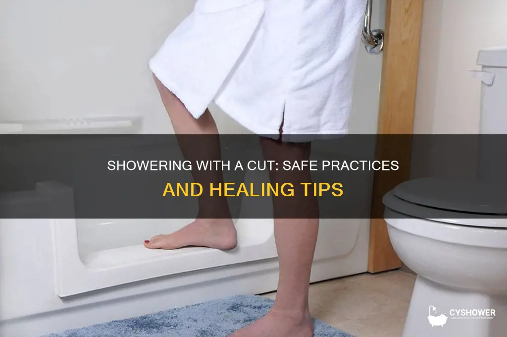 is it okay to shower after you get a cut