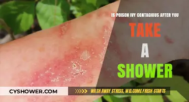 Can Poison Ivy Spread After Showering? Debunking the Contagious Myth
