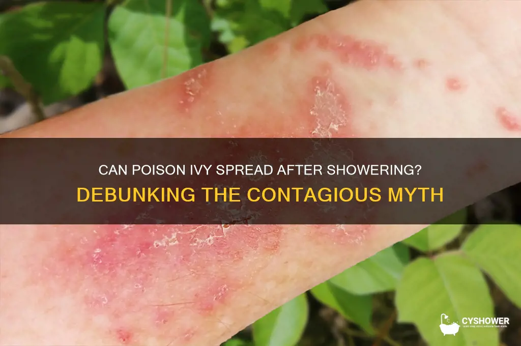 is poison ivy contagious after you take a shower