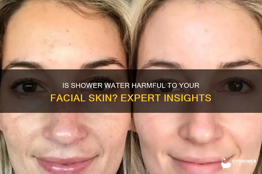 is shower water bad for your face