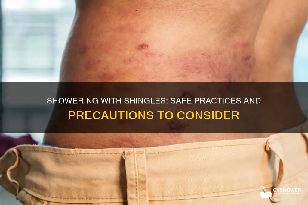 may i take shower with shingles