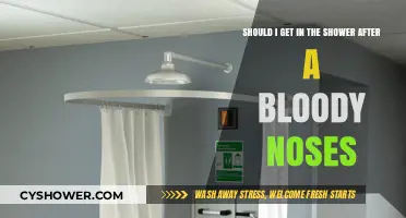 Post-Nosebleed Shower: Safe Practice or Risky Move?