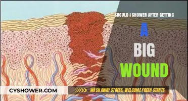 Should You Shower After a Big Wound? Healing Tips and Advice
