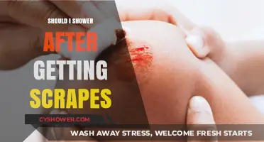 Should You Shower After Scrapes? Expert Tips for Wound Care