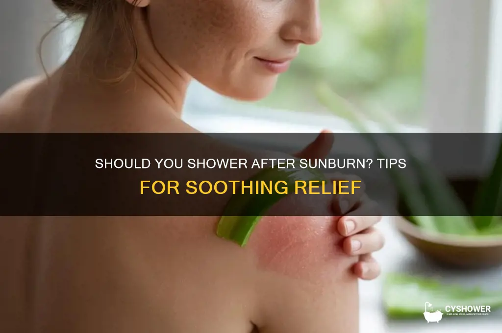 should i shower after getting sunburned