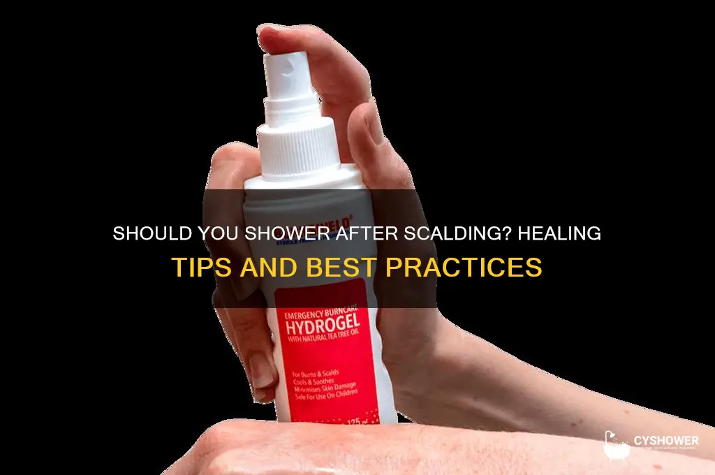 should i take a shower after scalding