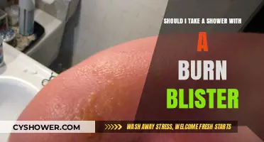Burn Blister Care: Is Showering Safe or Risky?
