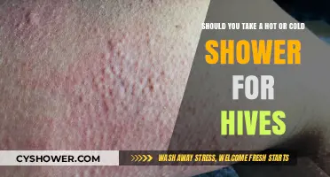 Hot or Cold Showers: Which Relieves Hives Symptoms Better?