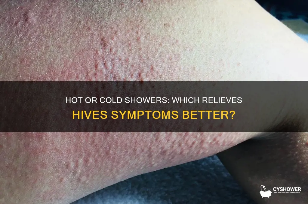 should you take a hot or cold shower for hives