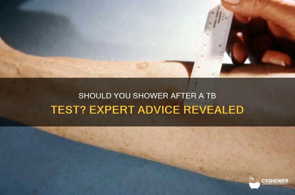 should you take a shower after a tb test