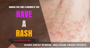 Rash Relief: Should You Shower or Avoid Water?