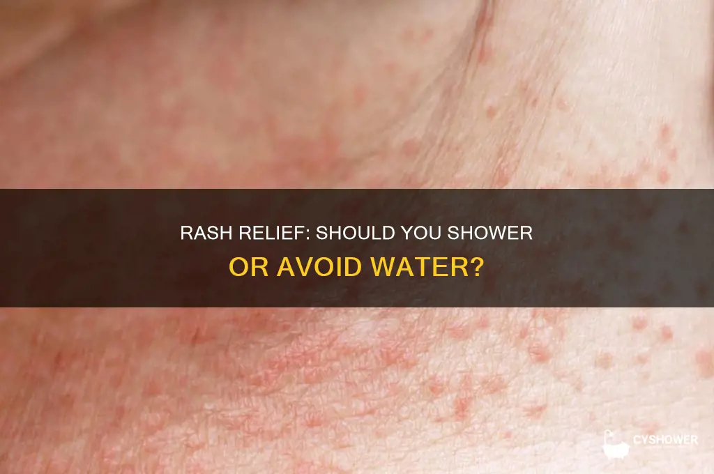 should you take a shower if you have a rash