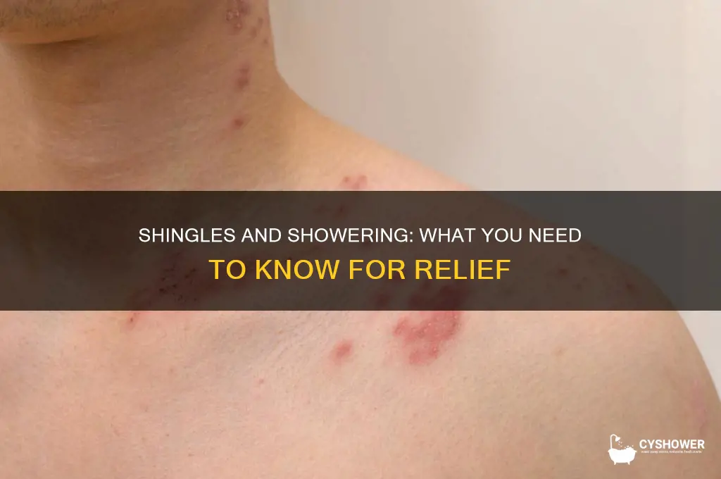 should you take a shower if you have shingles