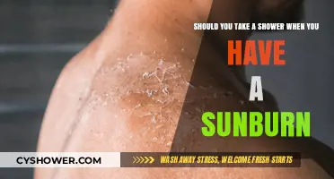Sunburn Relief: Should You Shower or Avoid the Water?