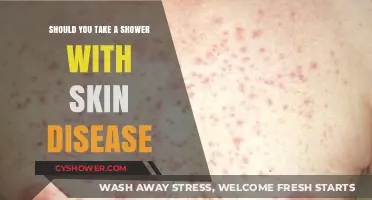 Showering with Skin Conditions: Safe Practices and Expert Advice