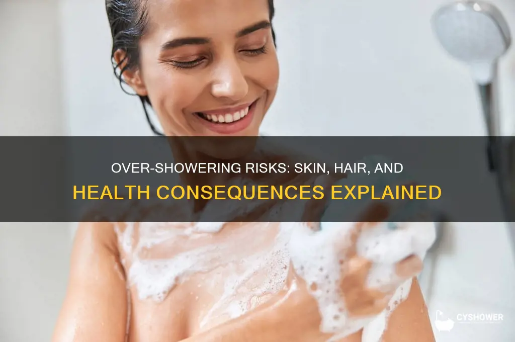 what can happen if you shower too much