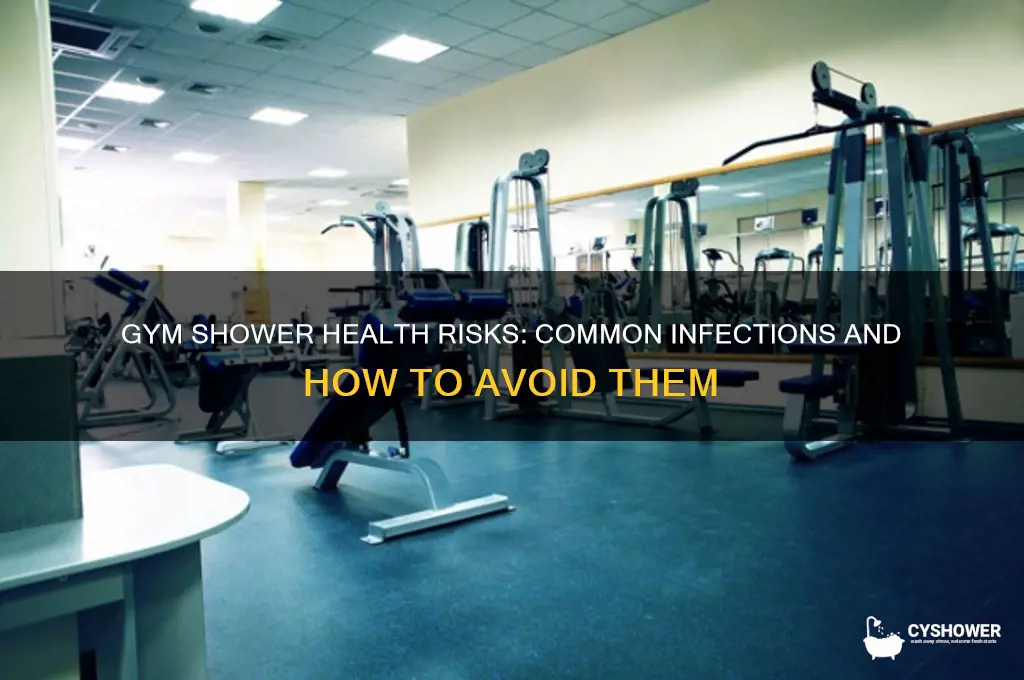 what can you catch from gym shower