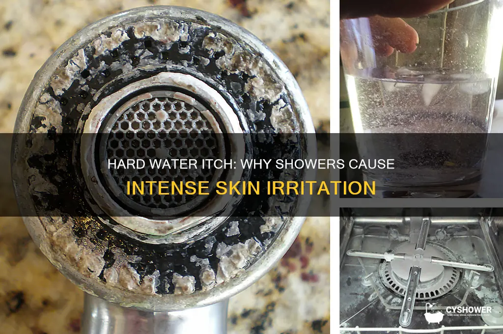 what causes intense itching after shower in hard water
