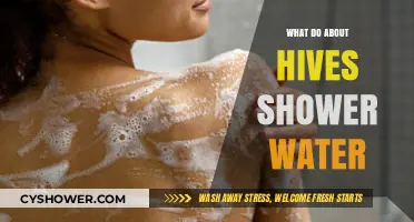 Soothing Hives from Shower Water: Effective Remedies and Prevention Tips
