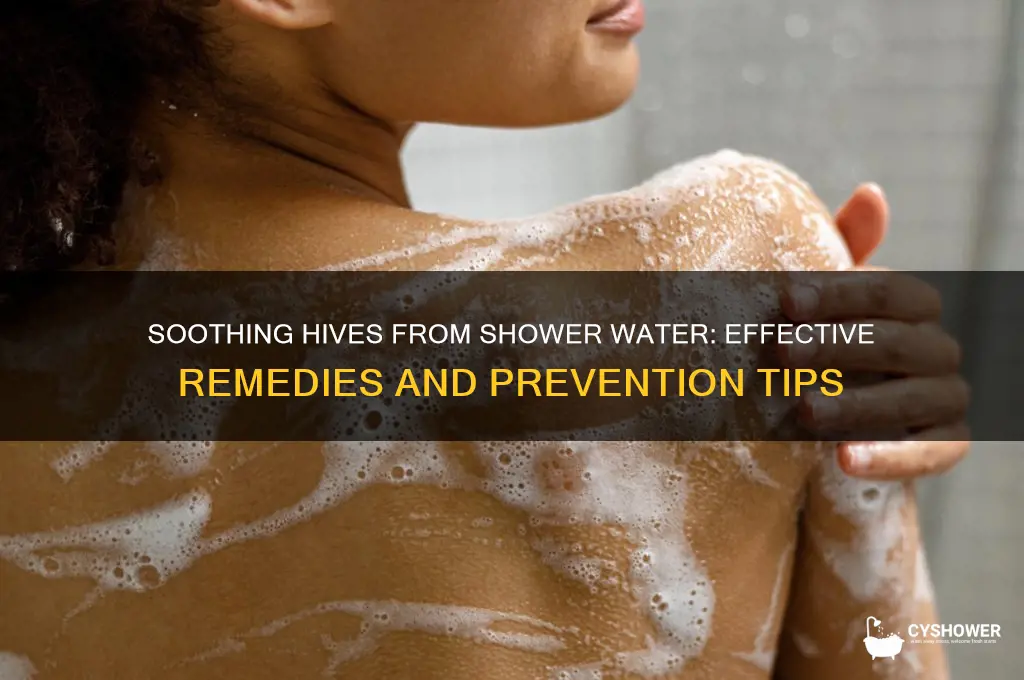 what do about hives shower water