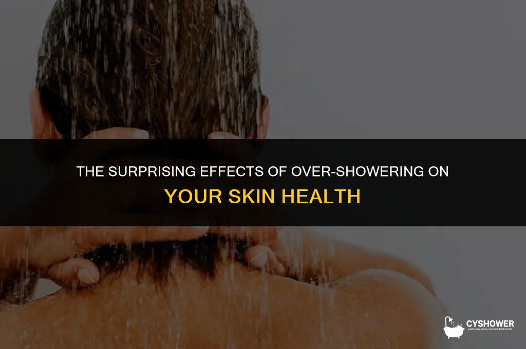 what happens when you shower too much skin