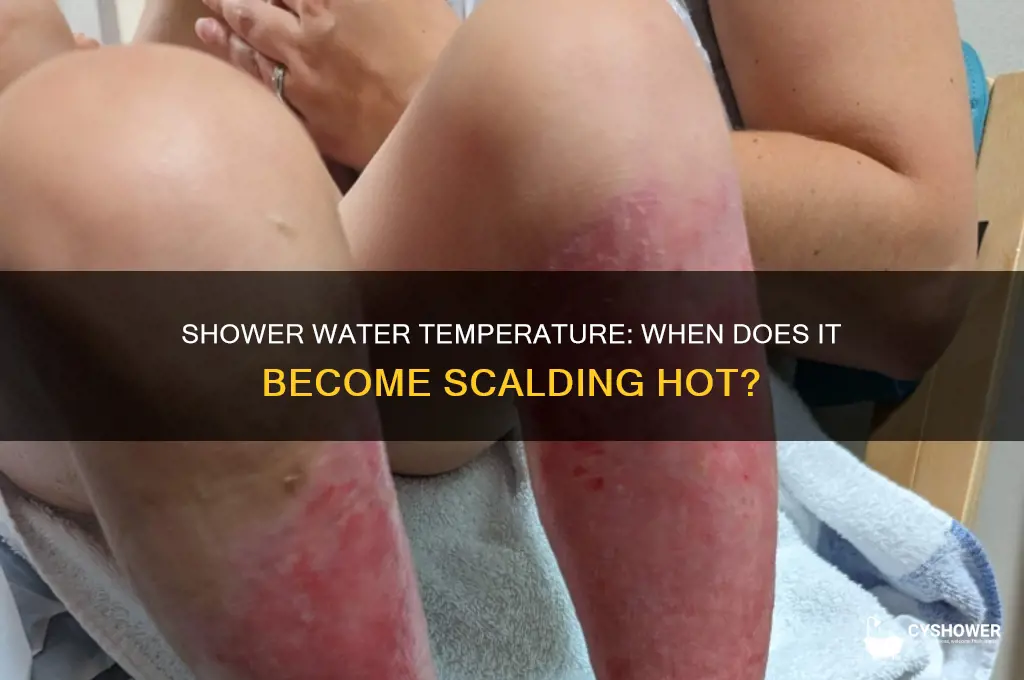 what temp is water scolding in a shower