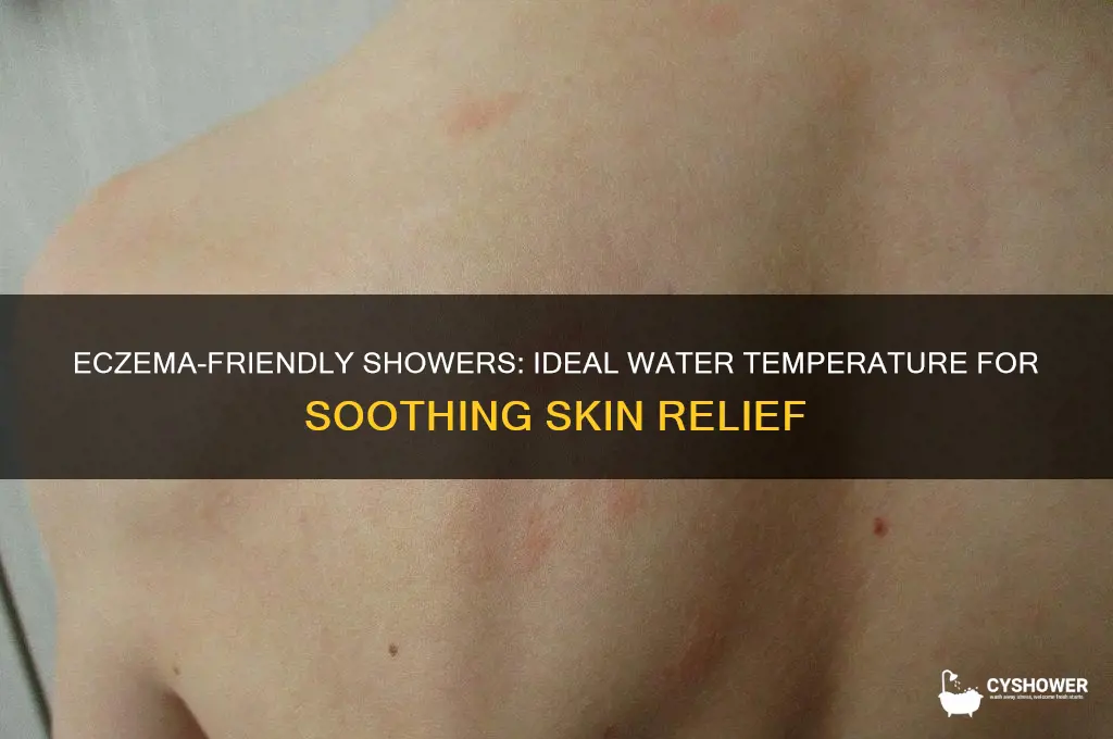 what temperature water should i shower if i have excema