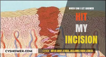 Healing Timeline: When Can You Safely Shower Your Incision?
