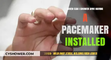 Pacemaker Recovery: When Can You Safely Shower After Installation?