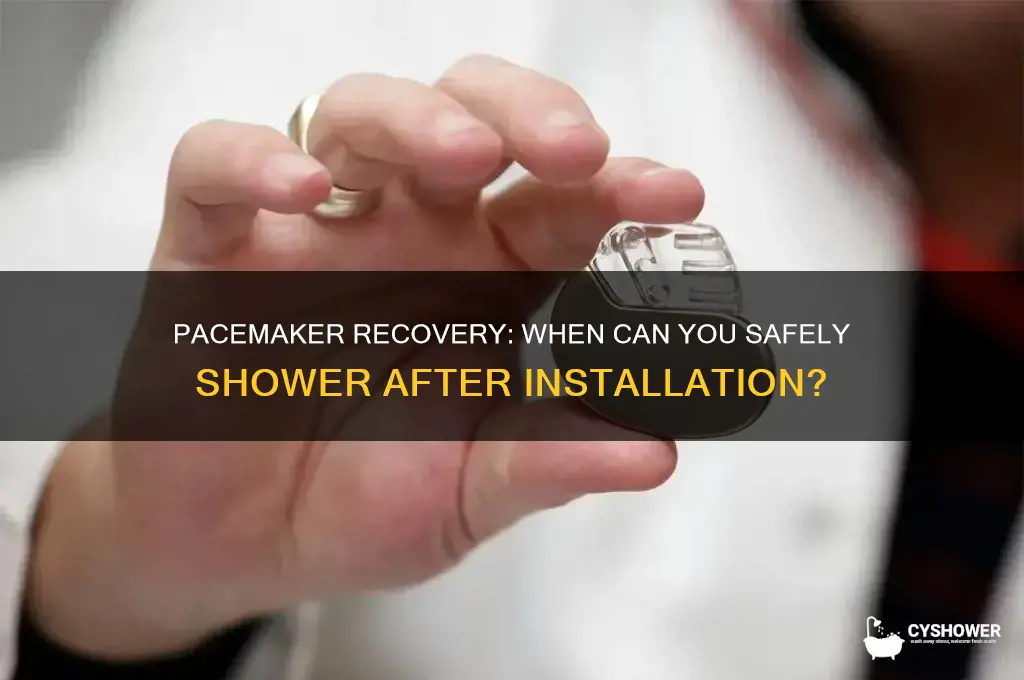 when can i shower afre having a pacemaker installed