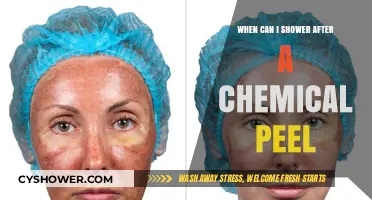 Post-Peel Shower Guide: When It’s Safe to Cleanse Your Skin