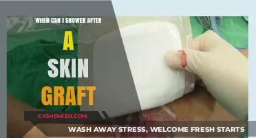 Post-Skin Graft Shower Guidelines: When It’s Safe to Cleanse
