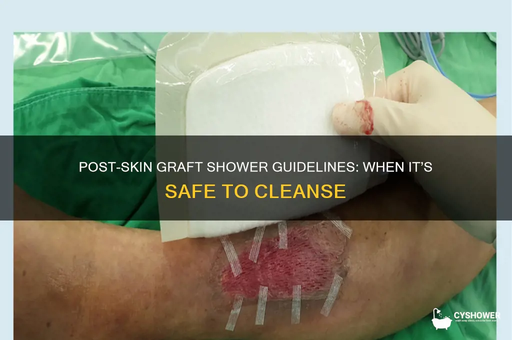 when can i shower after a skin graft