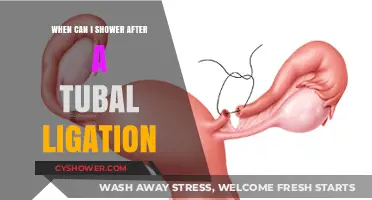 Post-Tubal Ligation Shower Guidelines: When Can You Safely Shower?