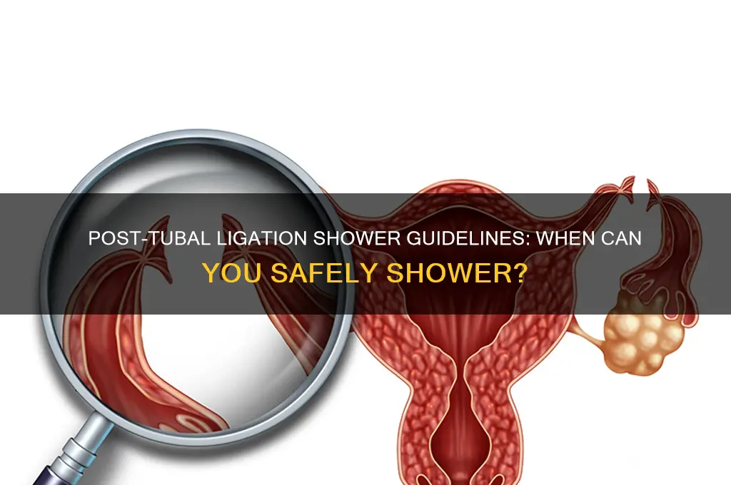 when can i shower after a tubal ligation