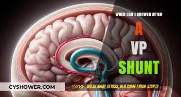 Post-VP Shunt Surgery: Safe Showering Timeline and Recovery Tips