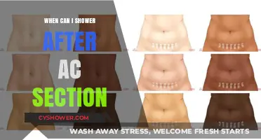 Post-C-Section Shower Guide: When It’s Safe to Lather Up