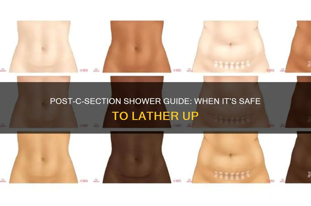 when can i shower after ac section