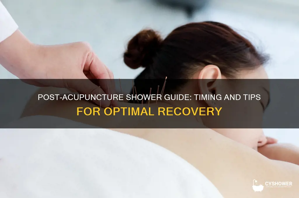 when can i shower after acupuncture