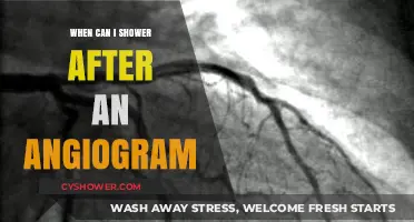 Post-Angiogram Shower Guidelines: When It’s Safe to Get Wet
