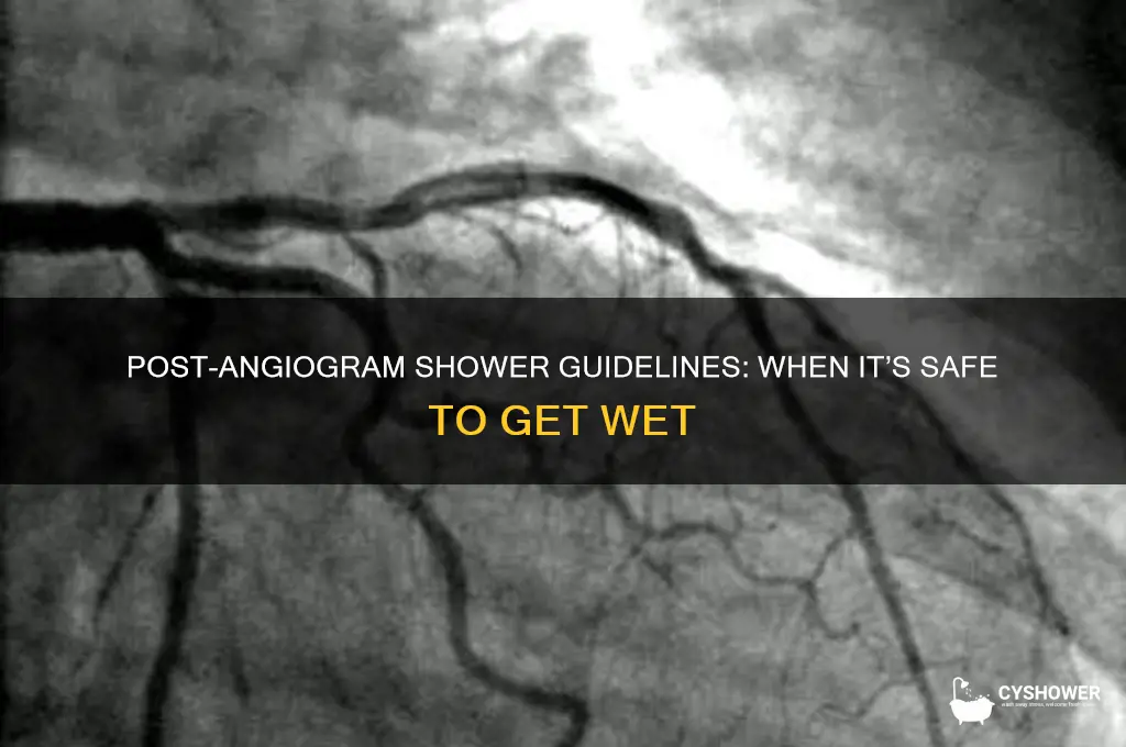 when can i shower after an angiogram
